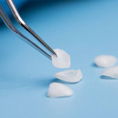 Dentist picking up one of several dental veneers on a light blue table
